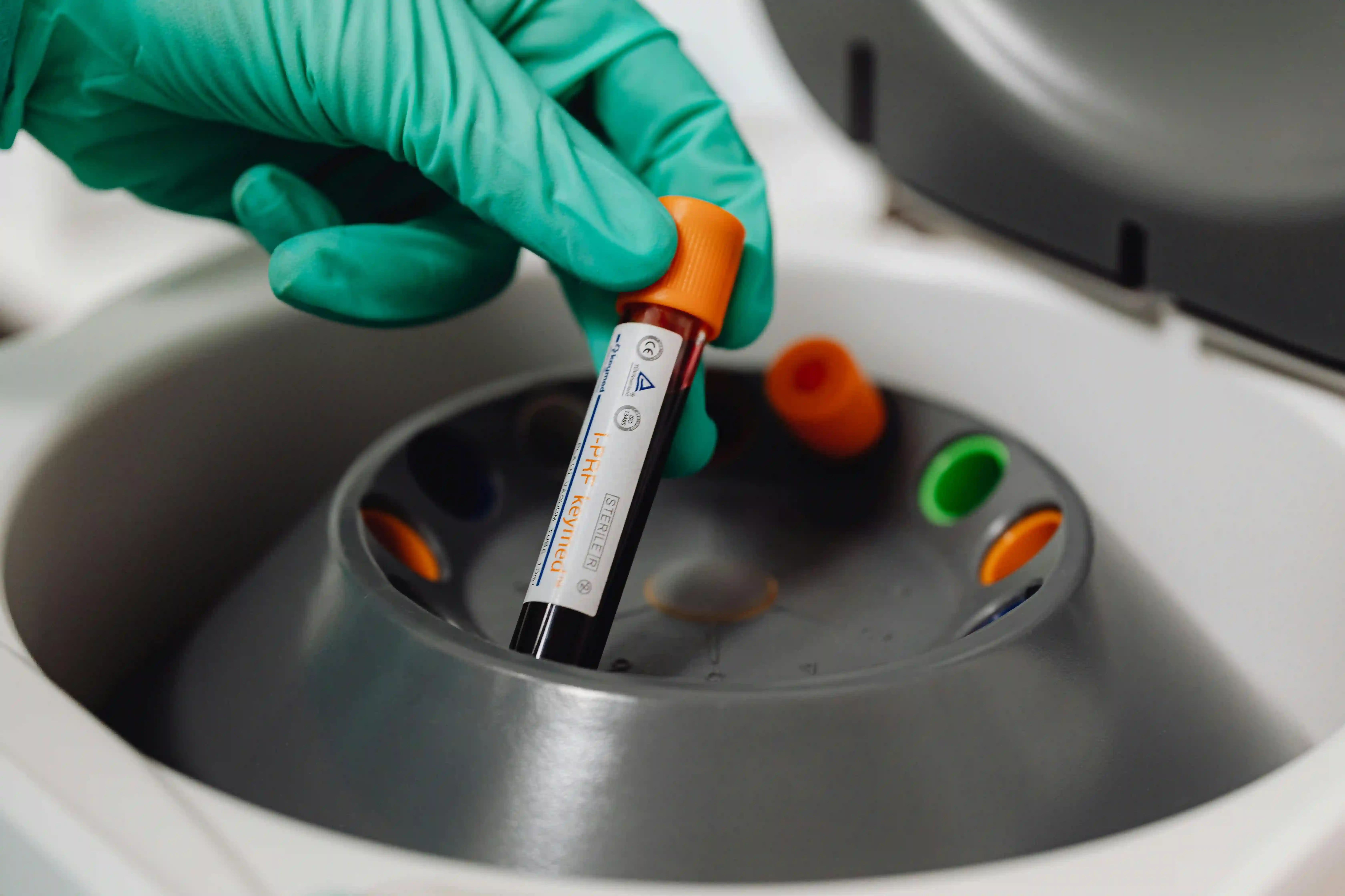 Centrifugeuse — Biologie de la reproduction, Laboratoire Rabat